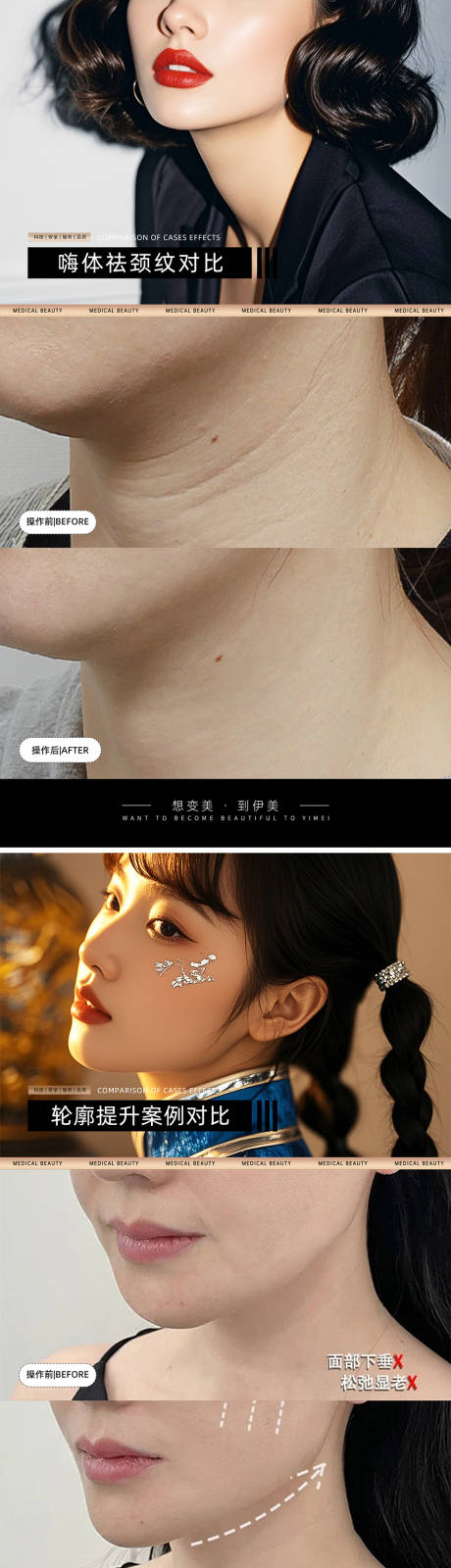 源文件下載【享設(shè)計(jì)】搜索編號(hào)：29570026581884422【醫(yī)美案例對(duì)比模板】