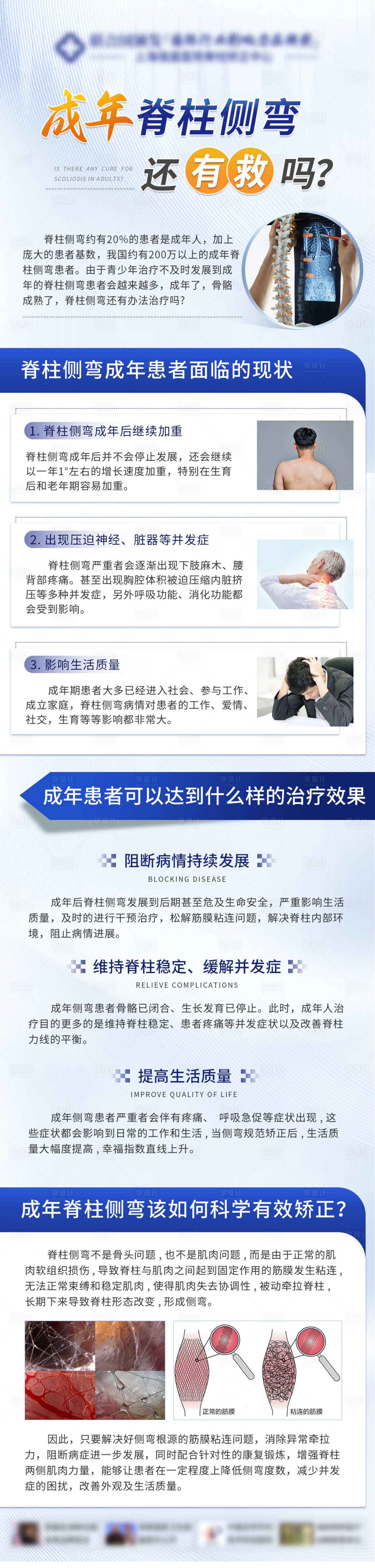 源文件下载【享设计】搜索编号：43940026716488187【成年脊柱侧弯治疗科普】