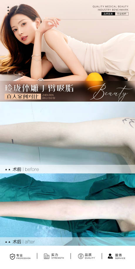 源文件下载【医美手臂吸脂案例海报】编号：35170026963845841