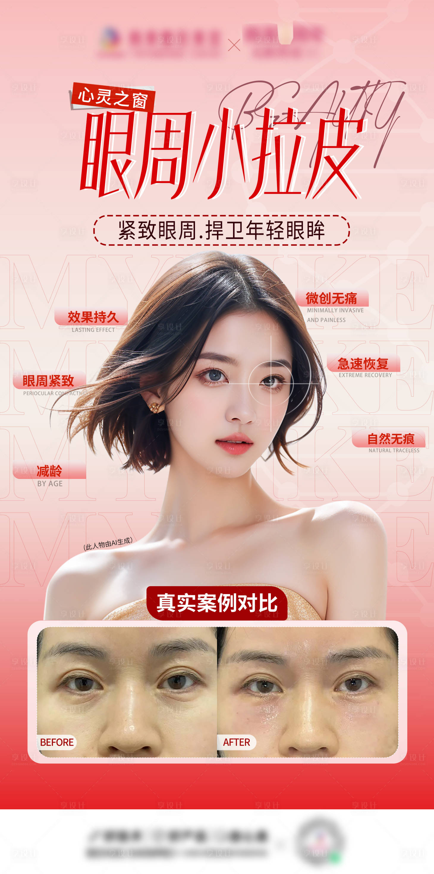 源文件下载【享设计】搜索编号：75160026670976734【眼周小拉皮案例海报】