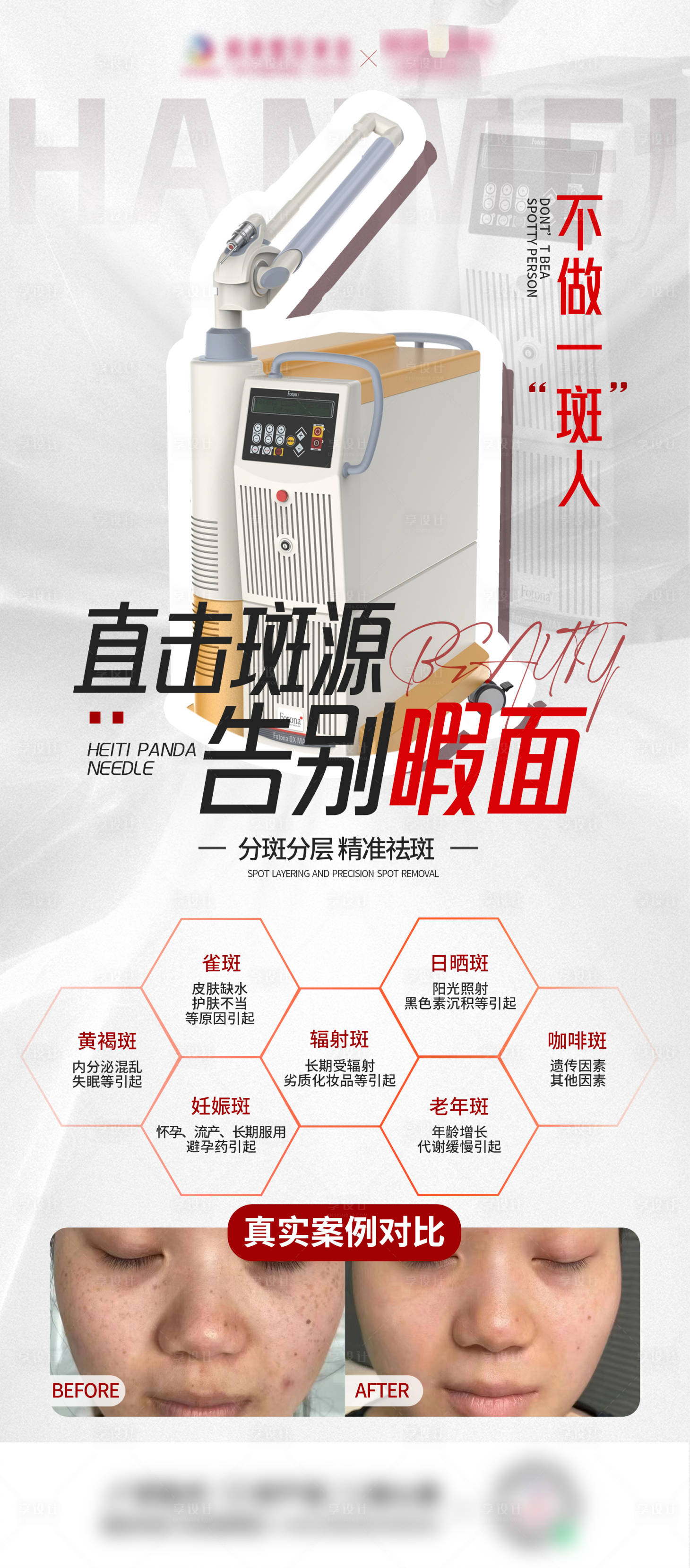 源文件下载【祛斑案例海报】编号：95410026670389839