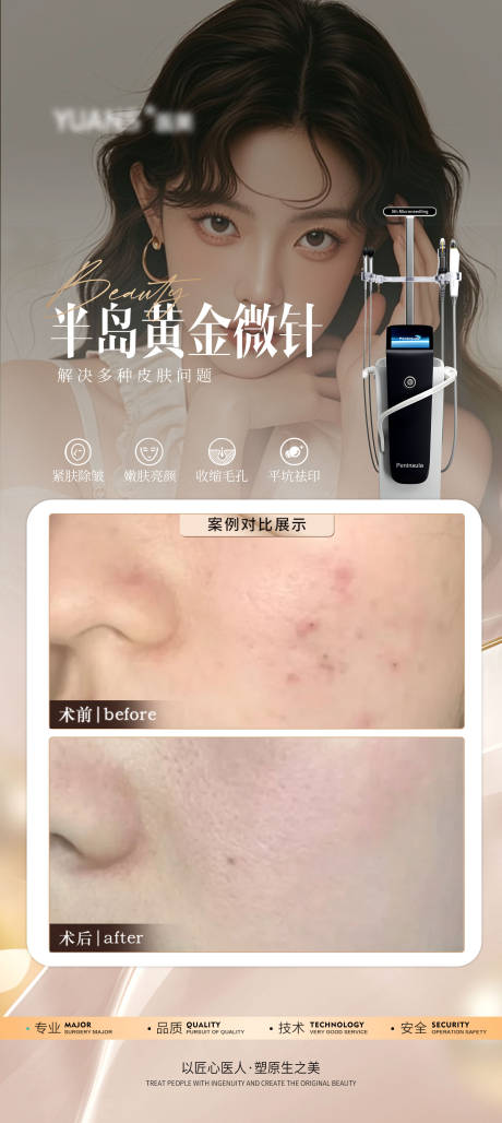 源文件下载【医美黄金微针祛痘案例海报】编号：54810026945878301
