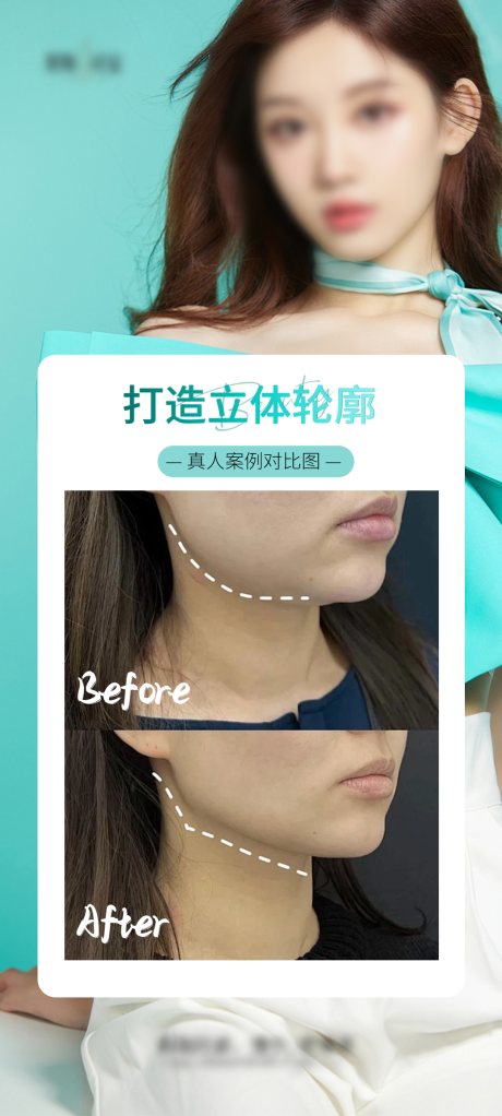 源文件下载【享设计】搜索编号：83580027047416513【医美v脸立体轮廓海报】