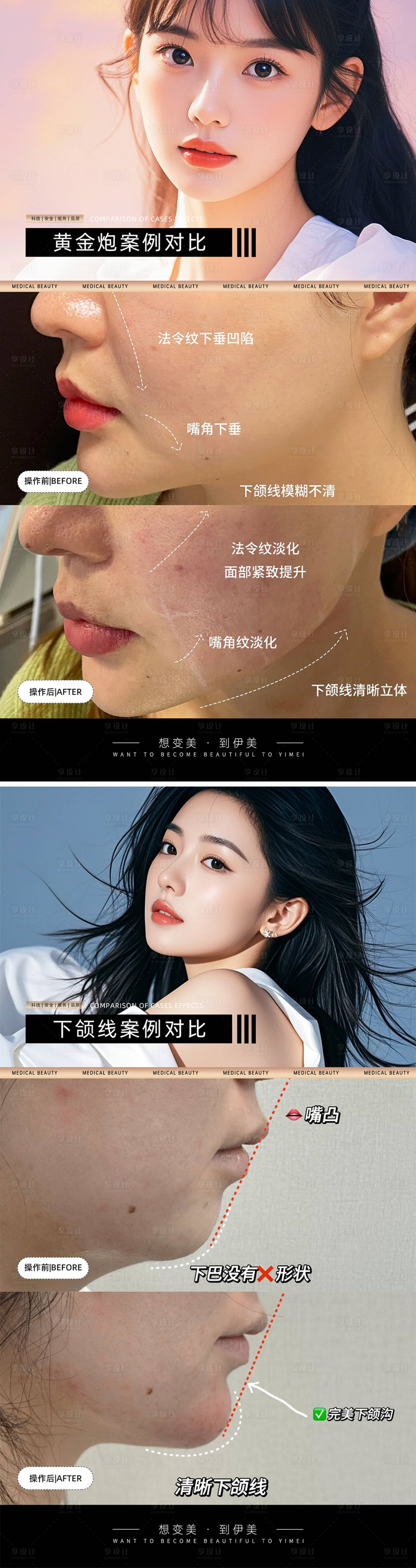 源文件下载【医美案例对比模板系列海报】编号：53060026671056297