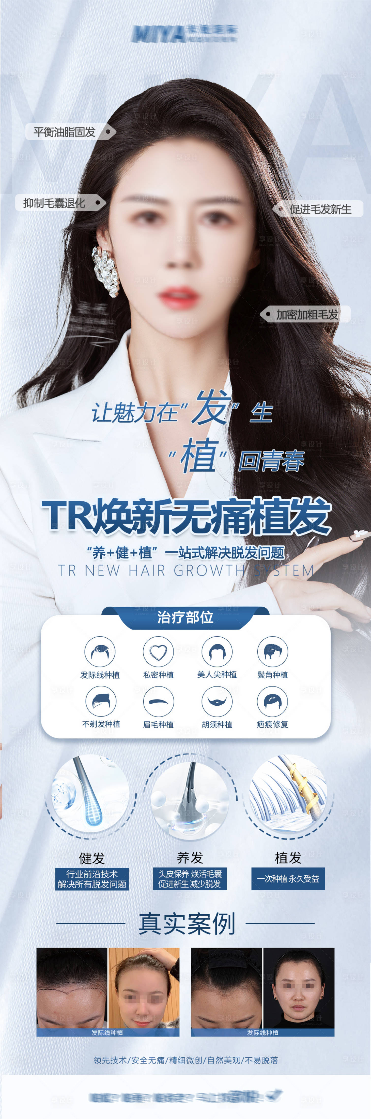 源文件下载【享设计】搜索编号：69780027039088584【植发活动医美活动】