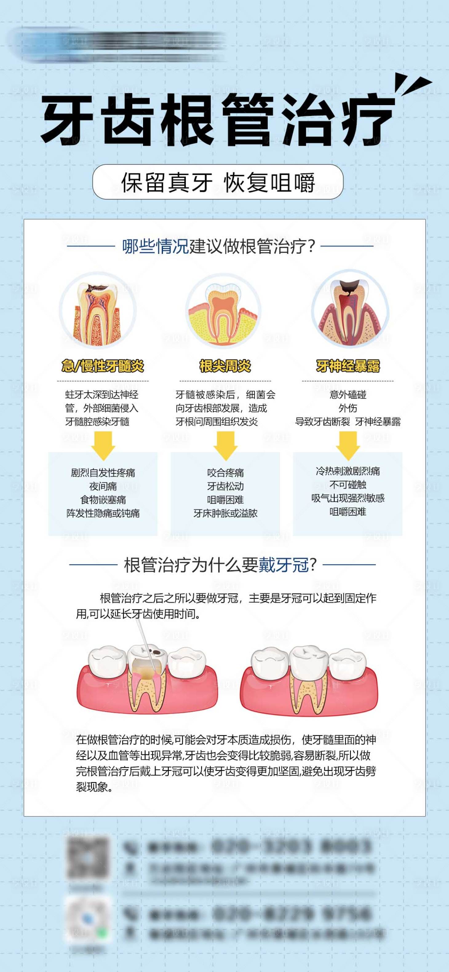 源文件下載【口腔牙齒根管治療海報(bào)】編號(hào)：85970026563285770