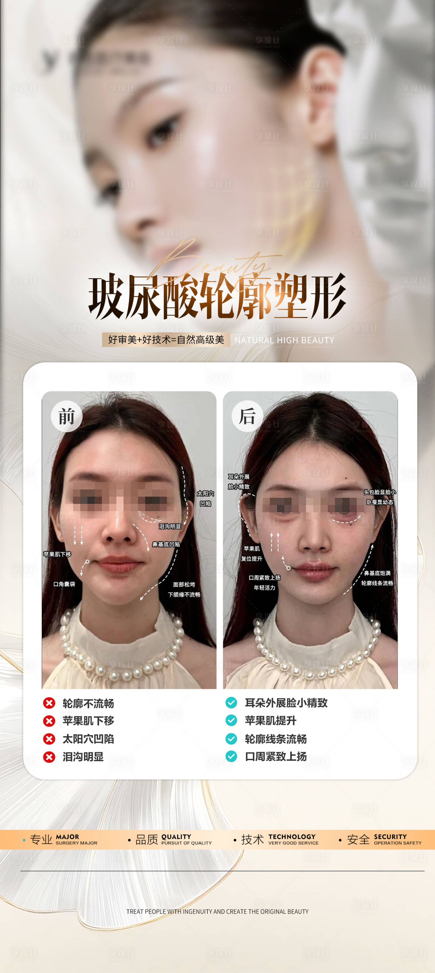 源文件下载【享设计】搜索编号：20770026642067821【医美玻尿酸外轮廓填充案例海报】