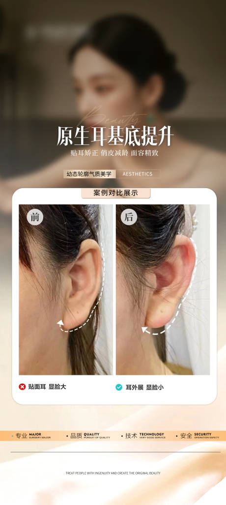 源文件下载【享设计】搜索编号：34610026622119175【耳基底填充海报】