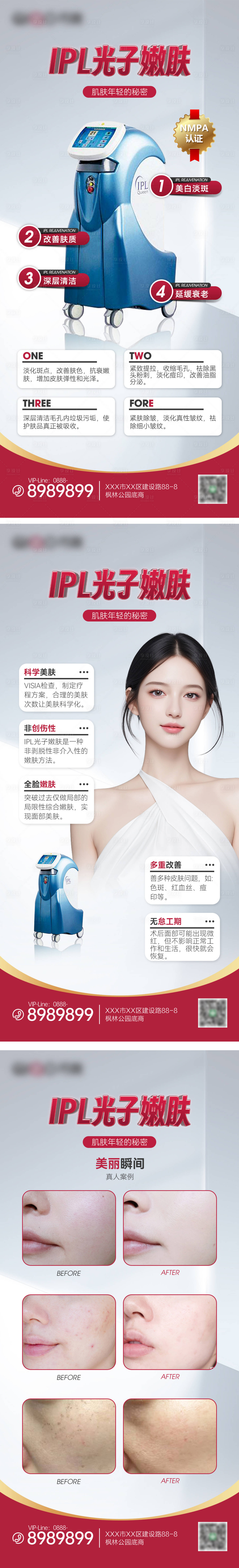 源文件下載【享設計】搜索編號：16950026868867522【醫美儀器IPL宣傳系列海報】