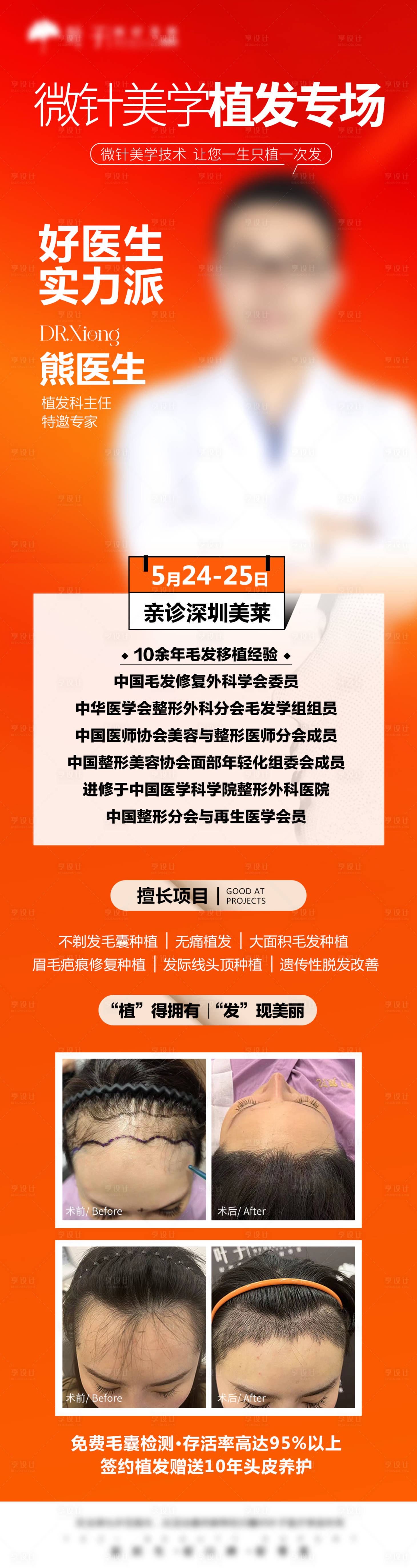 源文件下載【植發專場】編號：91810026575884222