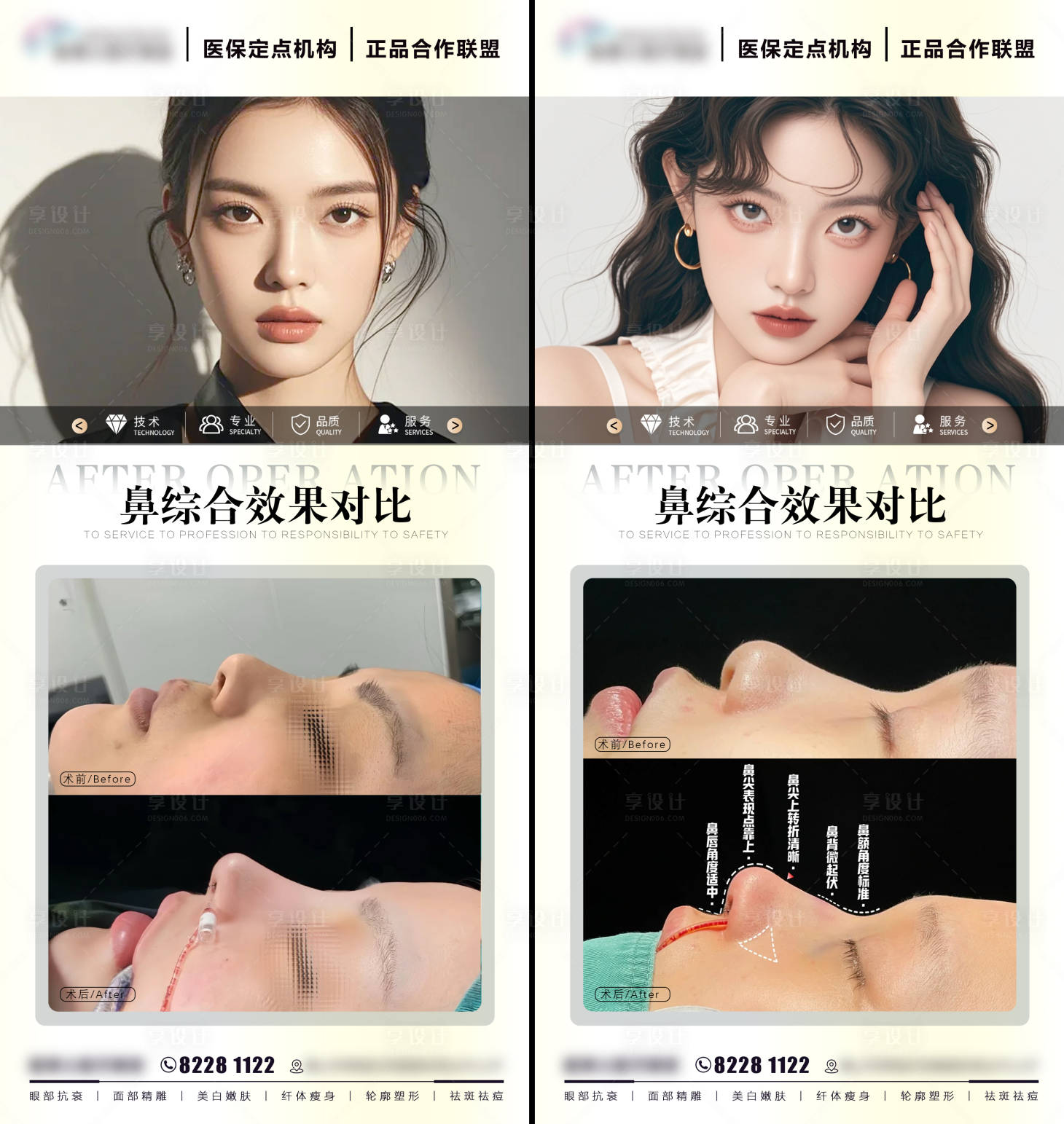 源文件下載【享設計】搜索編號：60210026858187861【隆鼻案例對比】