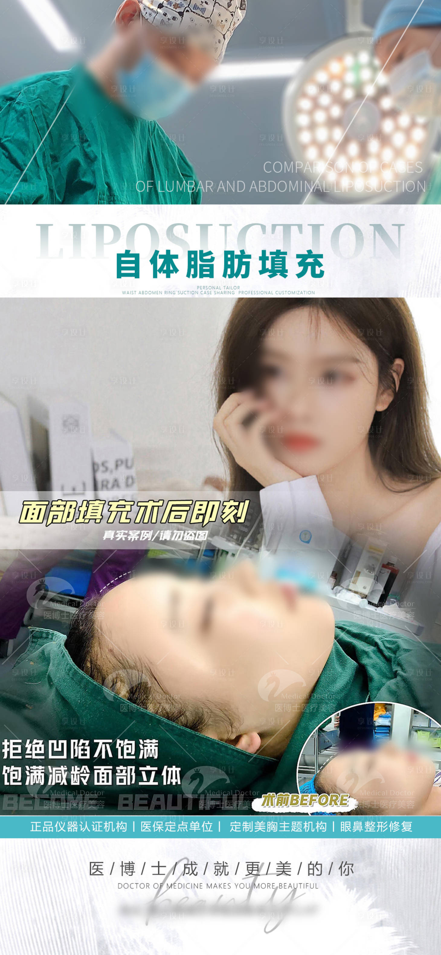 源文件下载【享设计】搜索编号：38960026785717639【脂肪填充脸部案例海报】