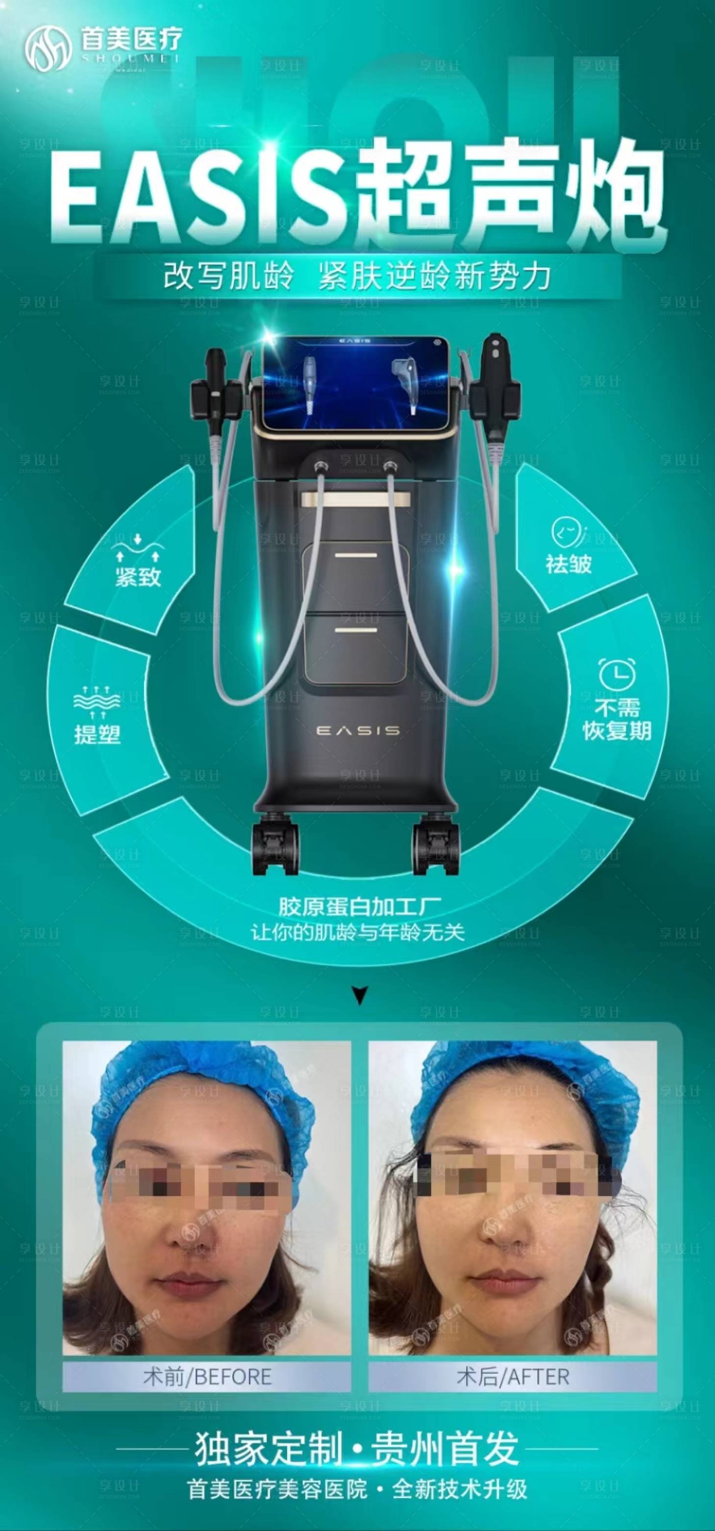 源文件下載【享設(shè)計(jì)】搜索編號(hào)：30330026654627250【超聲炮案例海報(bào)】
