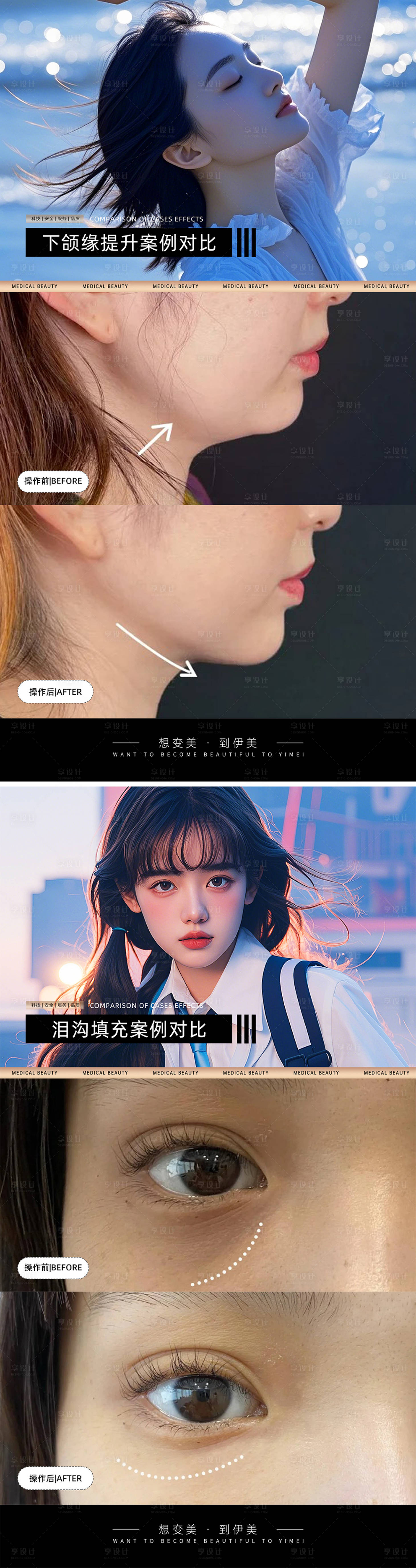 源文件下載【享設計】搜索編號：32850026819881990【醫美案例對比模版】