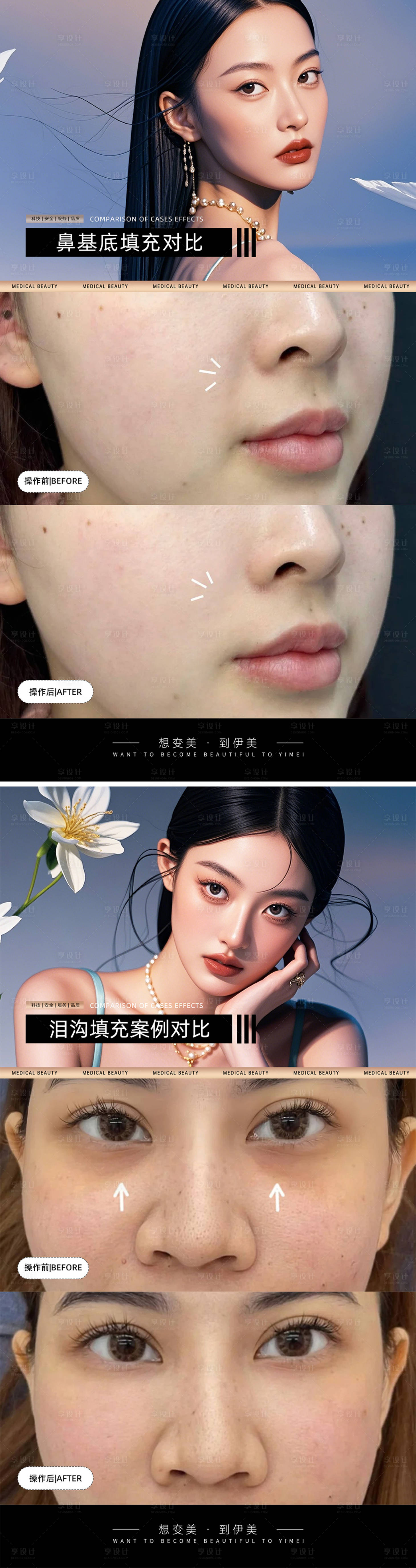 源文件下载【享设计】搜索编号：77490026799489711【医美案例对比模版】