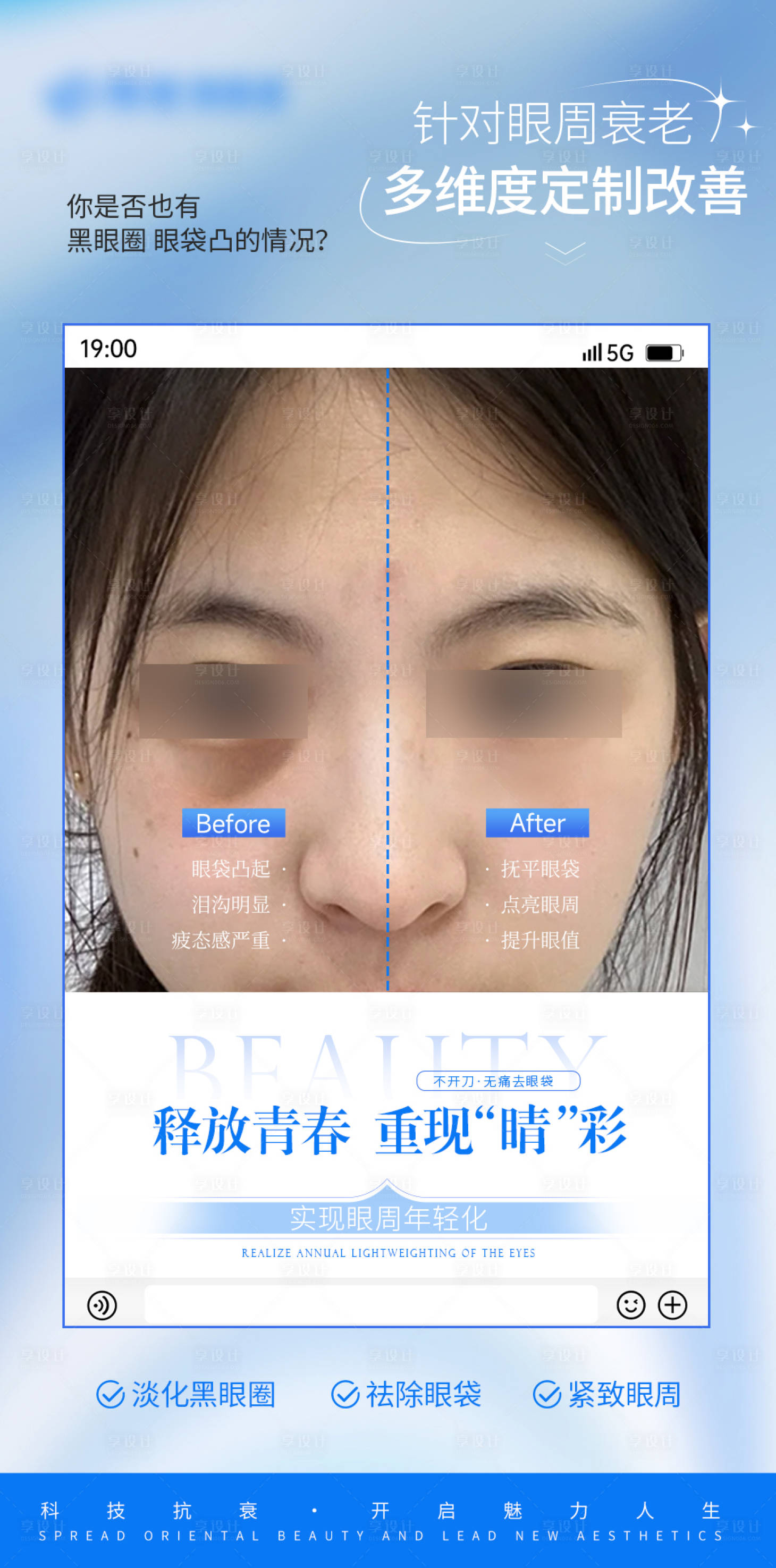 源文件下载【享设计】搜索编号：85340026950306682【医美眼周年轻化抗衰对比海报】