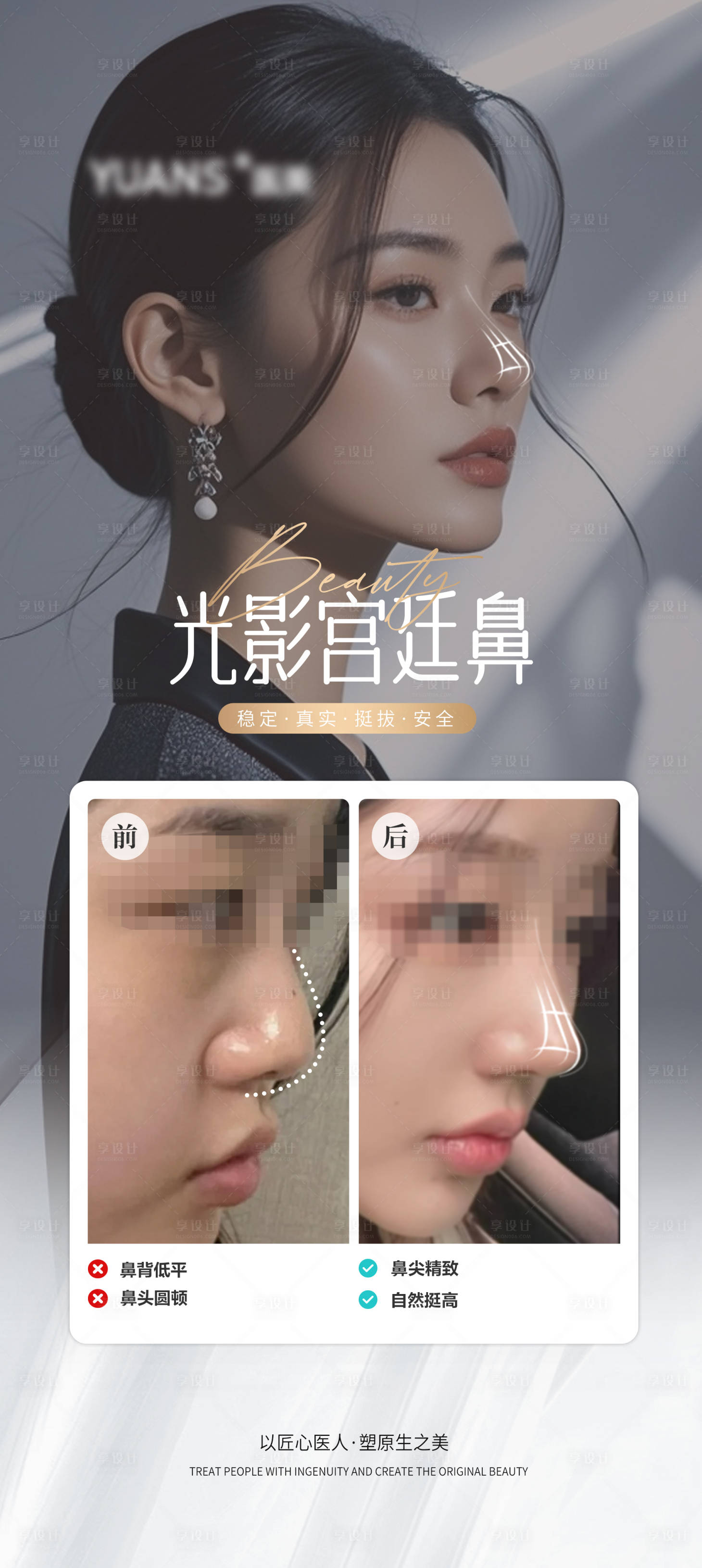 源文件下載【享設計】搜索編號：18280026948797808【醫美隆鼻案例】