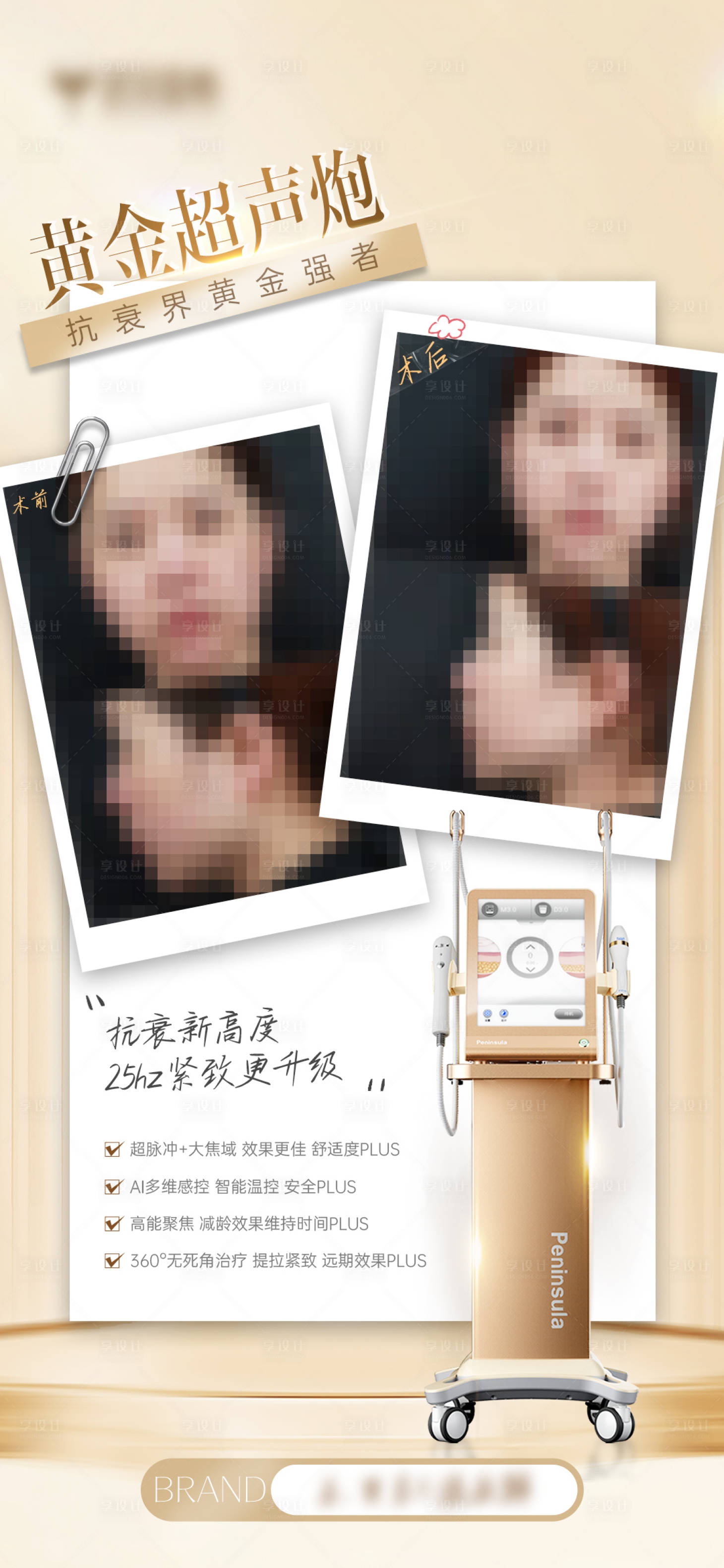 源文件下载【享设计】搜索编号：26830026571156669【黄金超声炮案例对比海报】