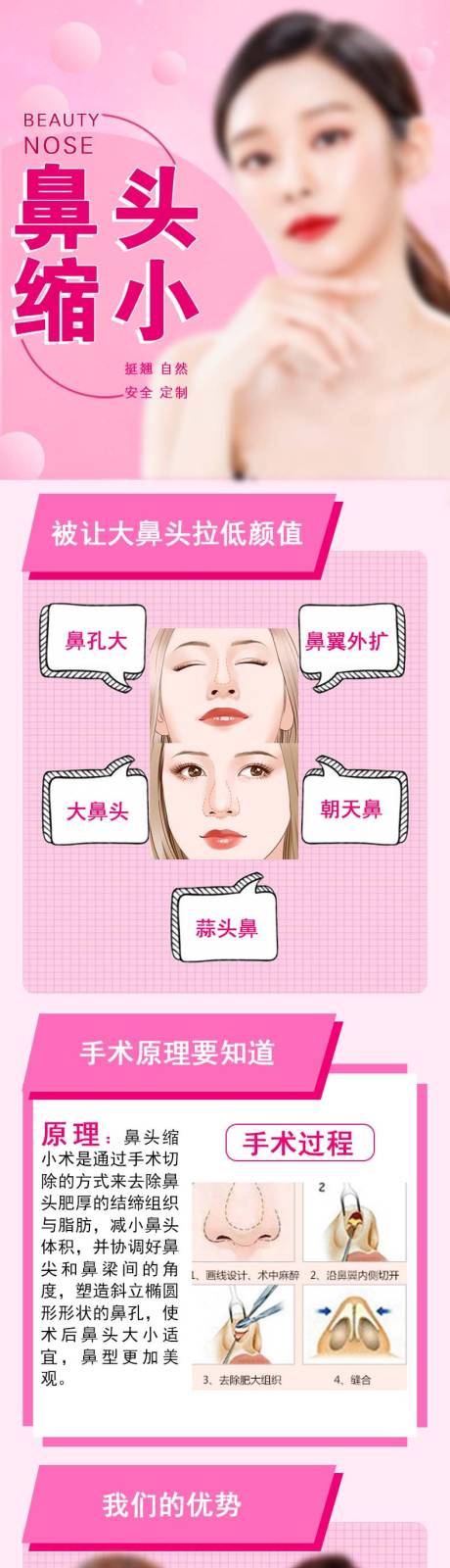 医美美业鼻头缩小详情页