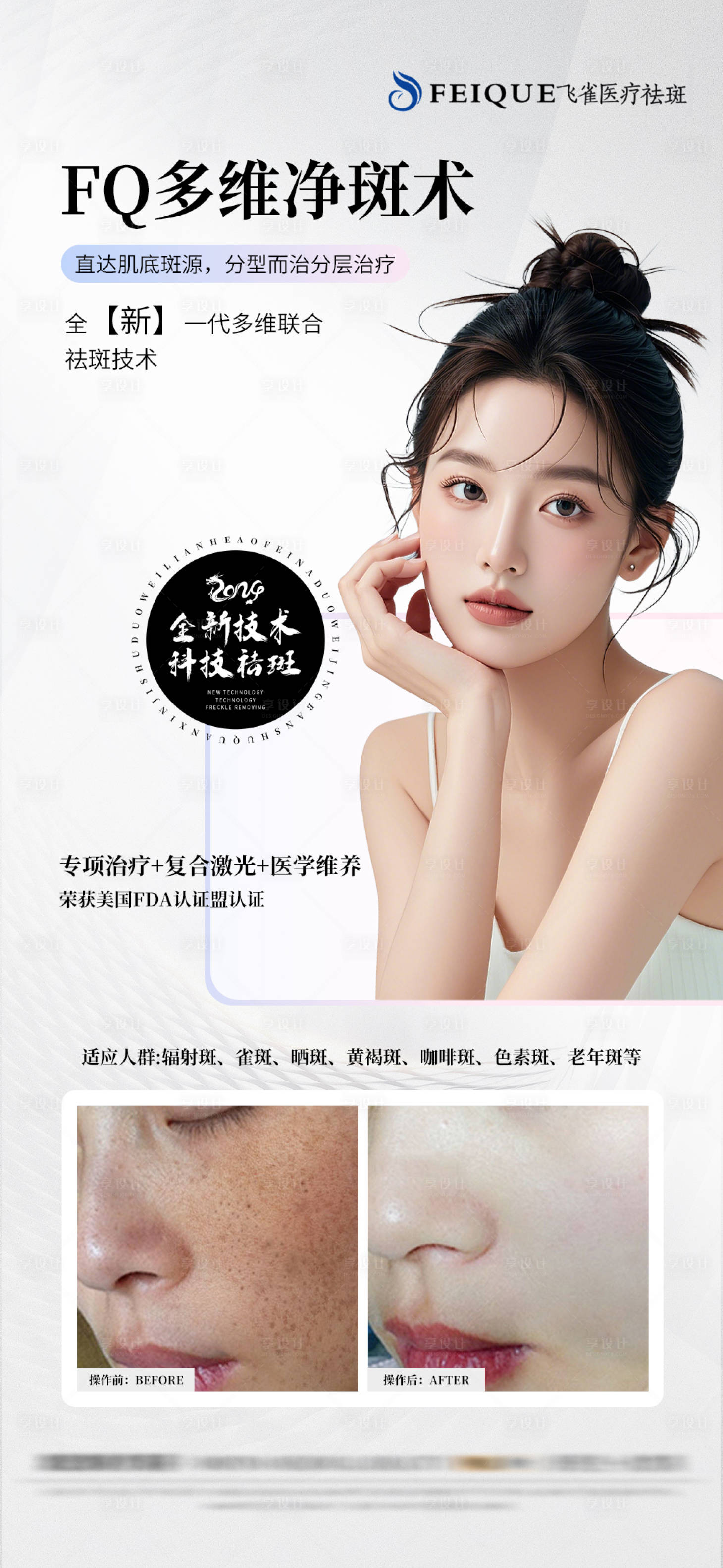 源文件下載【享設計】搜索編號：44940026780285162【醫美祛斑海報對比】