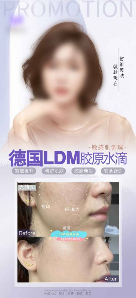 源文件下载【医美对比海报】编号：10250027004599106
