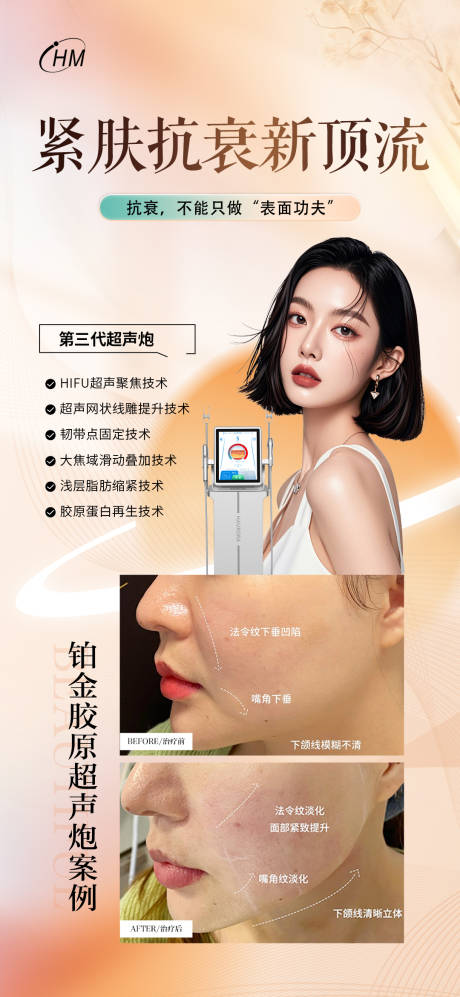 源文件下载【享设计】搜索编号：72470027237149779【超声炮抗衰案例】