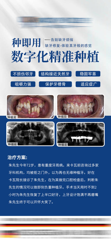 源文件下载【牙齿种植案例海报】编号：37930027551722100