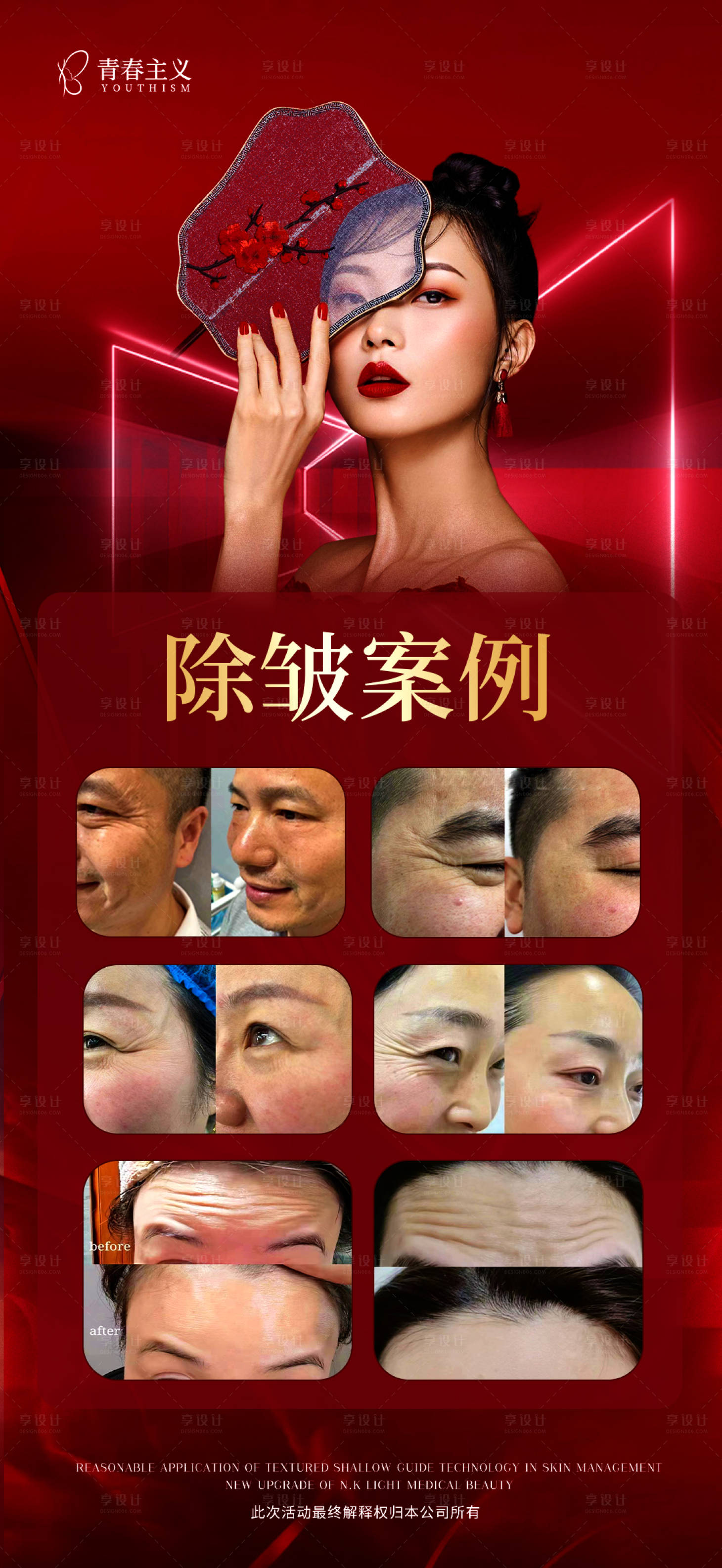 源文件下载【享设计】搜索编号：75190027175666203【除皱案例】