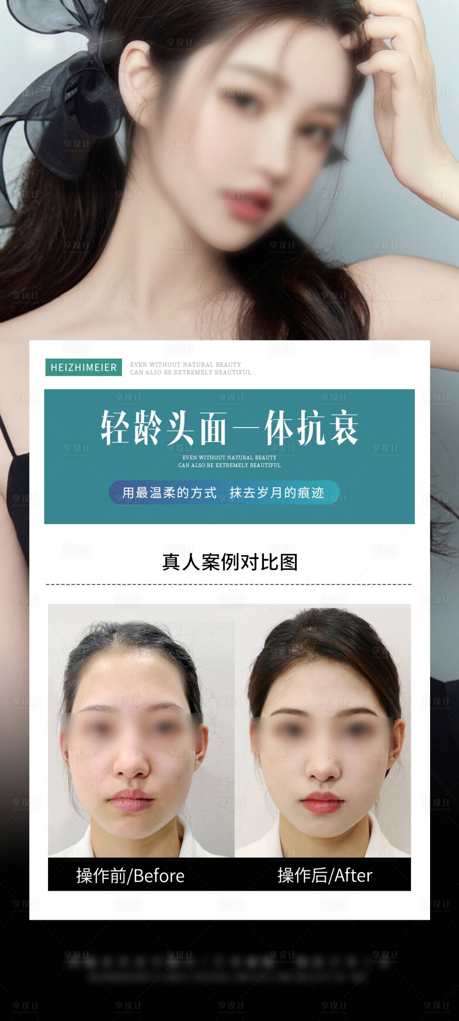 源文件下載【享設計】搜索編號：64440027408075277【醫(yī)美輕齡抗衰海報】
