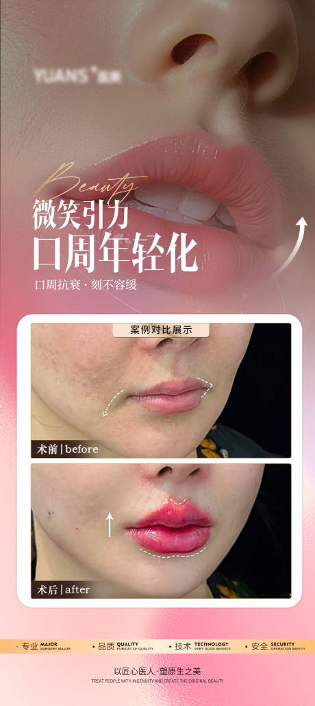 医美口周案例对比图