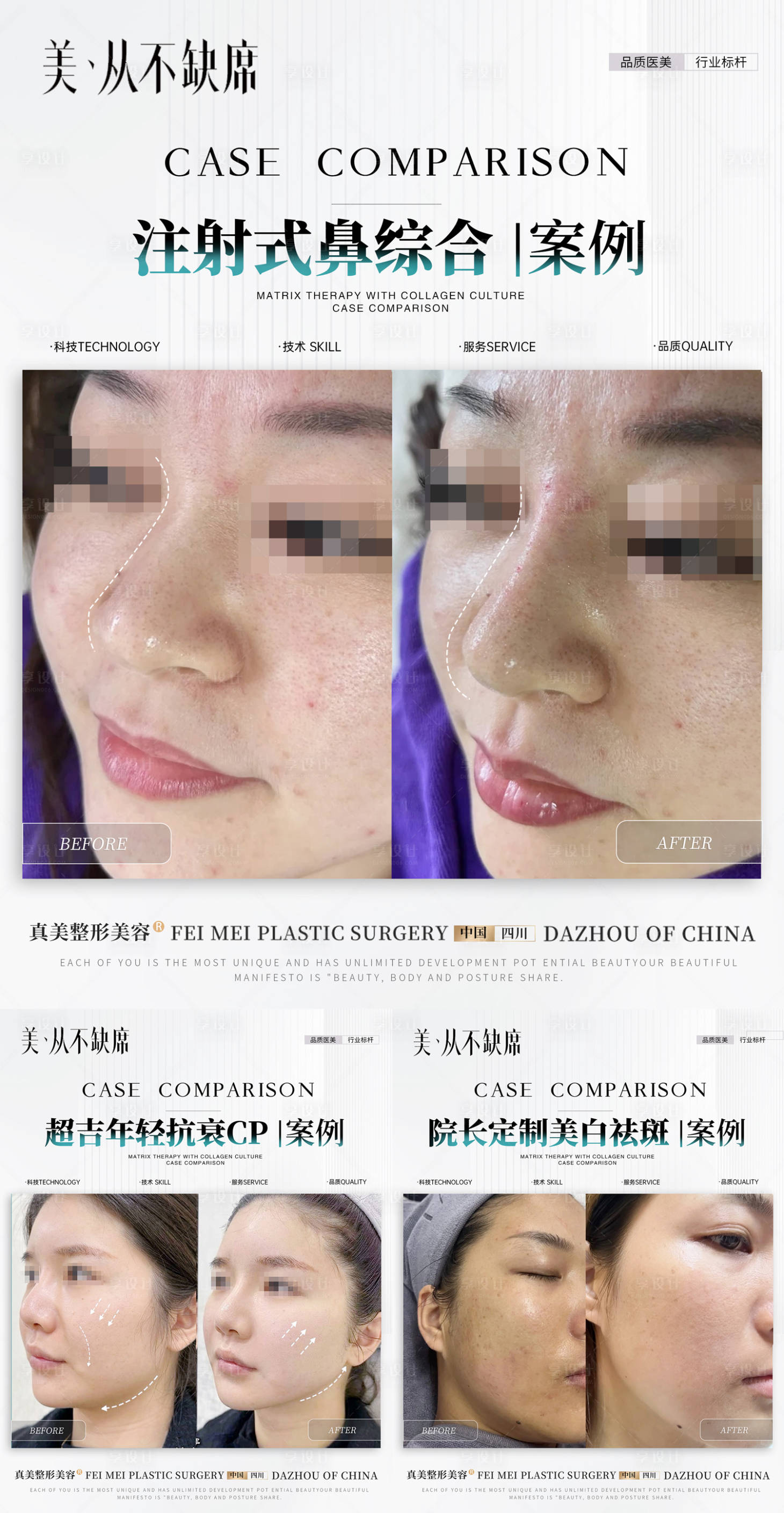 源文件下載【美業(yè)案例對比】編號：64510027140586127
