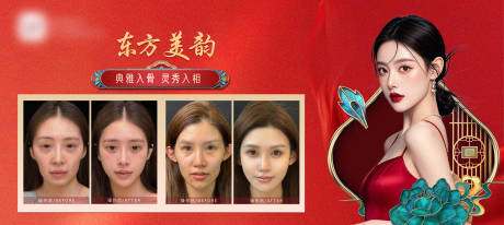 源文件下载【医美东方美韵对比案例上墙海报】编号：40740027109359368