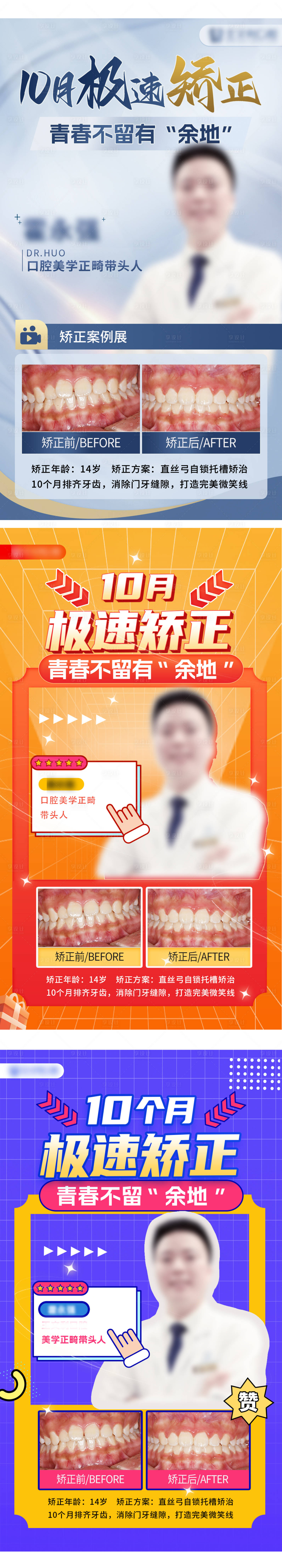 源文件下载【口腔牙齿矫正轮播电商海报】编号：47270027505982575