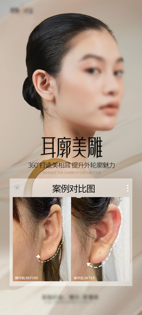 源文件下载【医美耳廓海报】编号：94660027189571207