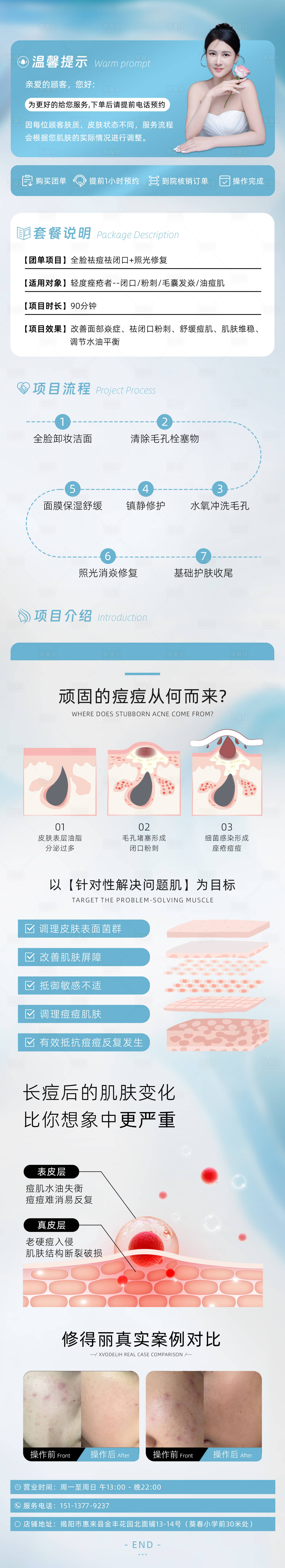 源文件下载【医美美容痘肌祛痘详情页项目介绍】编号：71670027293401429