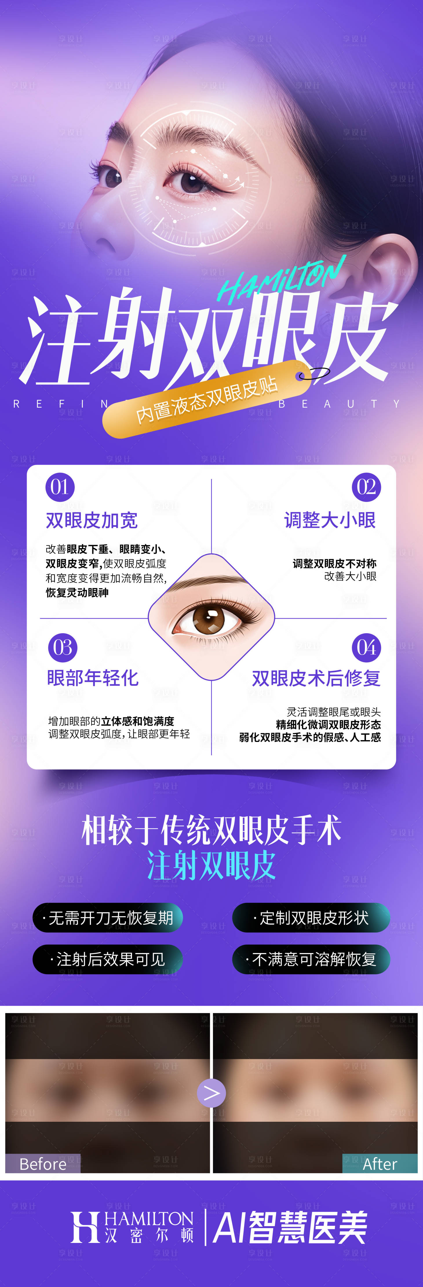源文件下載【享設(shè)計(jì)】搜索編號(hào)：84980027203635028【注射雙眼皮】