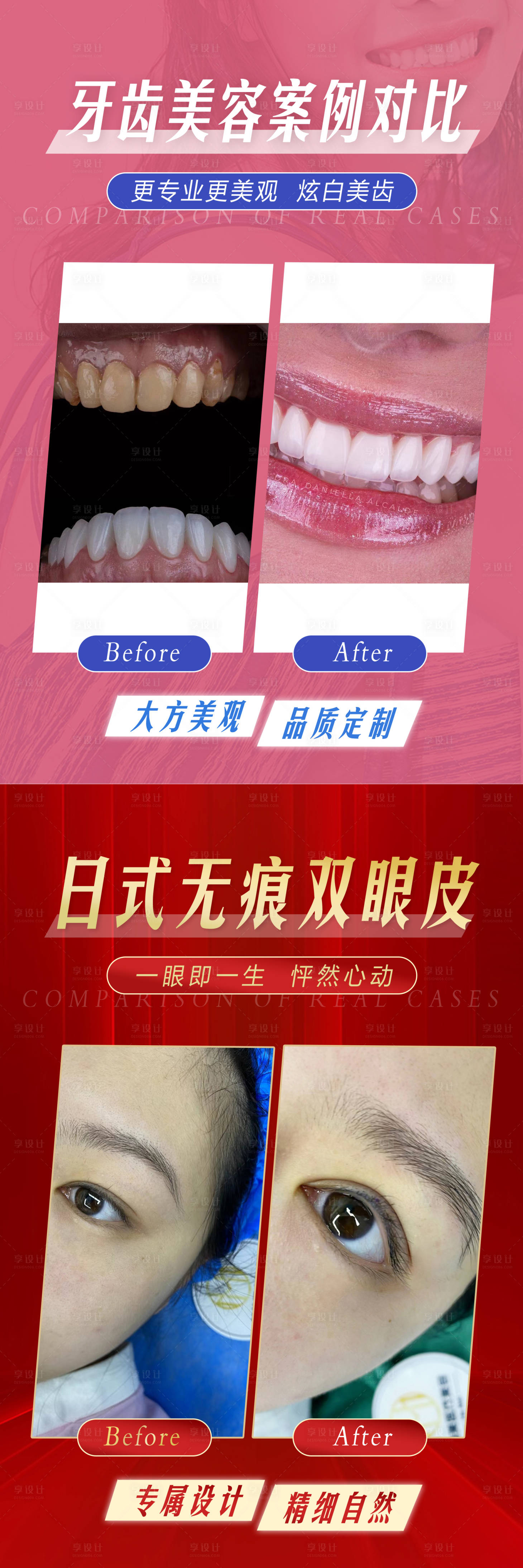 源文件下載【享設計】搜索編號：67290027223845292【醫美案例對比海報】