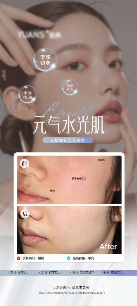 源文件下载【医美水光针案例宣传海报】编号：72500027086803534