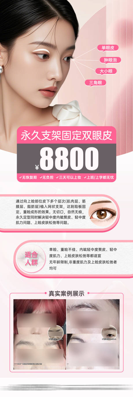 源文件下载【享设计】搜索编号：41280027374192931【医美双眼皮整形项目卡海报】