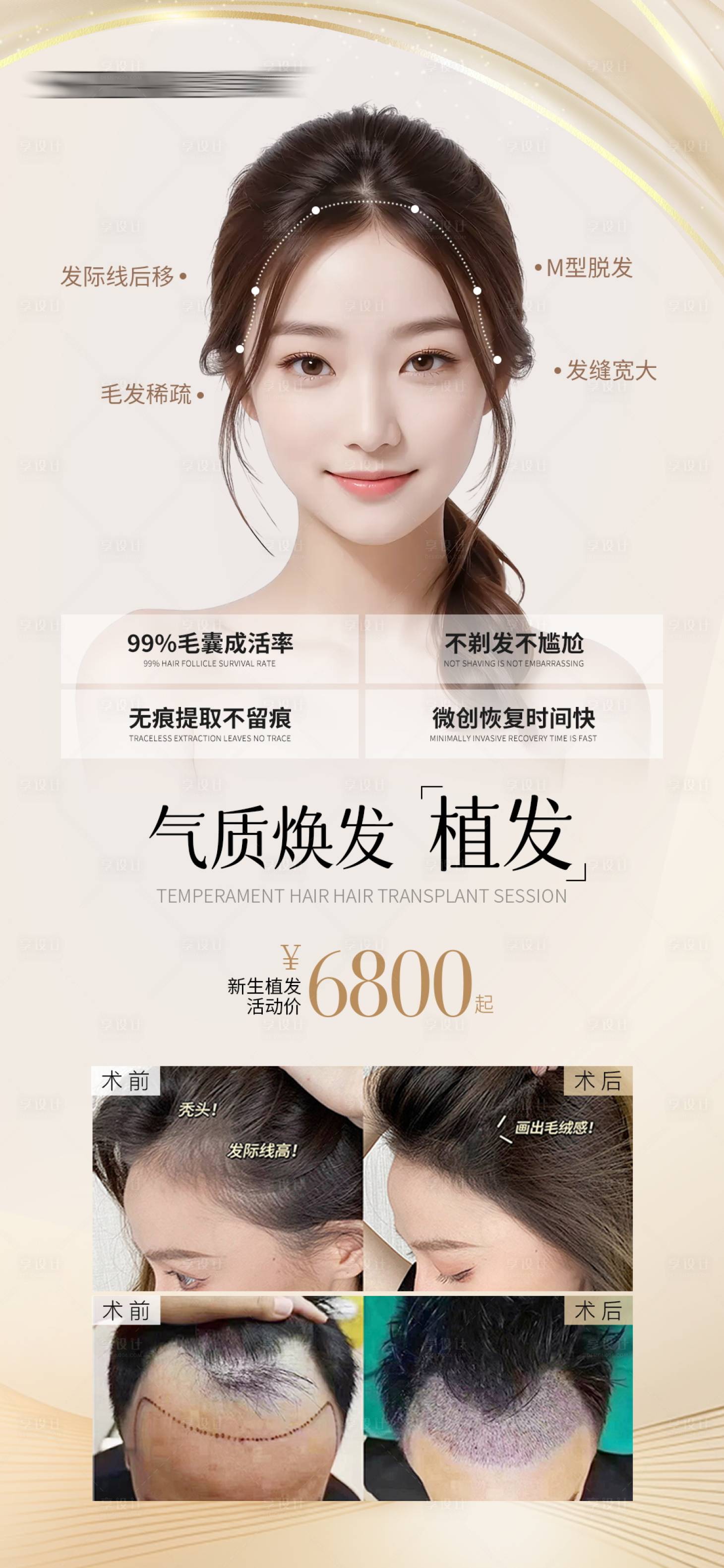 源文件下载【享设计】搜索编号：90380027523306456【植发美容案例海报】