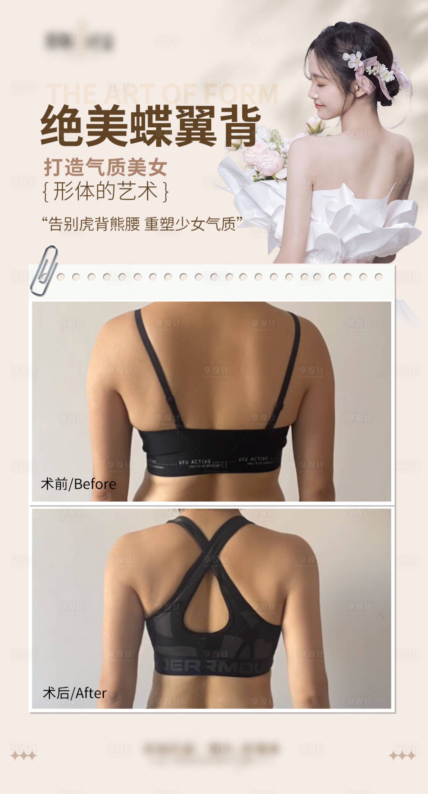 源文件下载【享设计】搜索编号：91900027210256221【医美少女背海报】