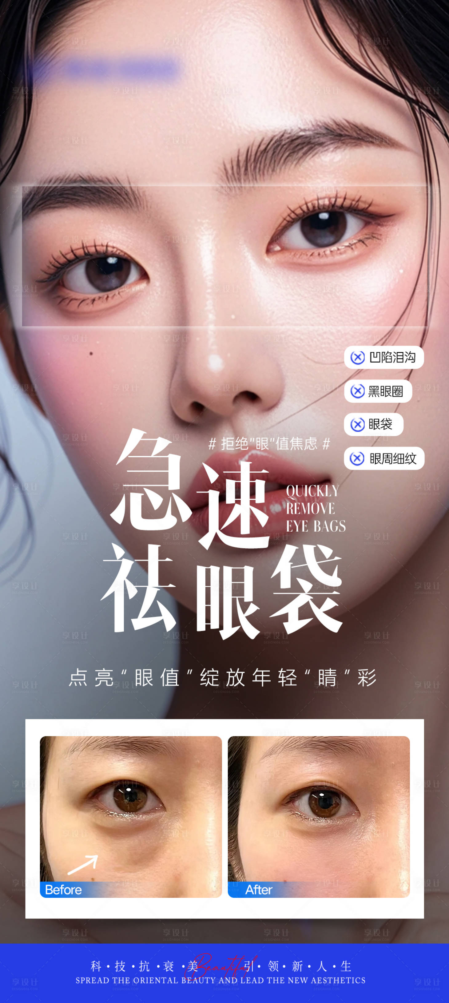 源文件下載【享設計】搜索編號：10390027540434023【醫美祛眼袋海報】