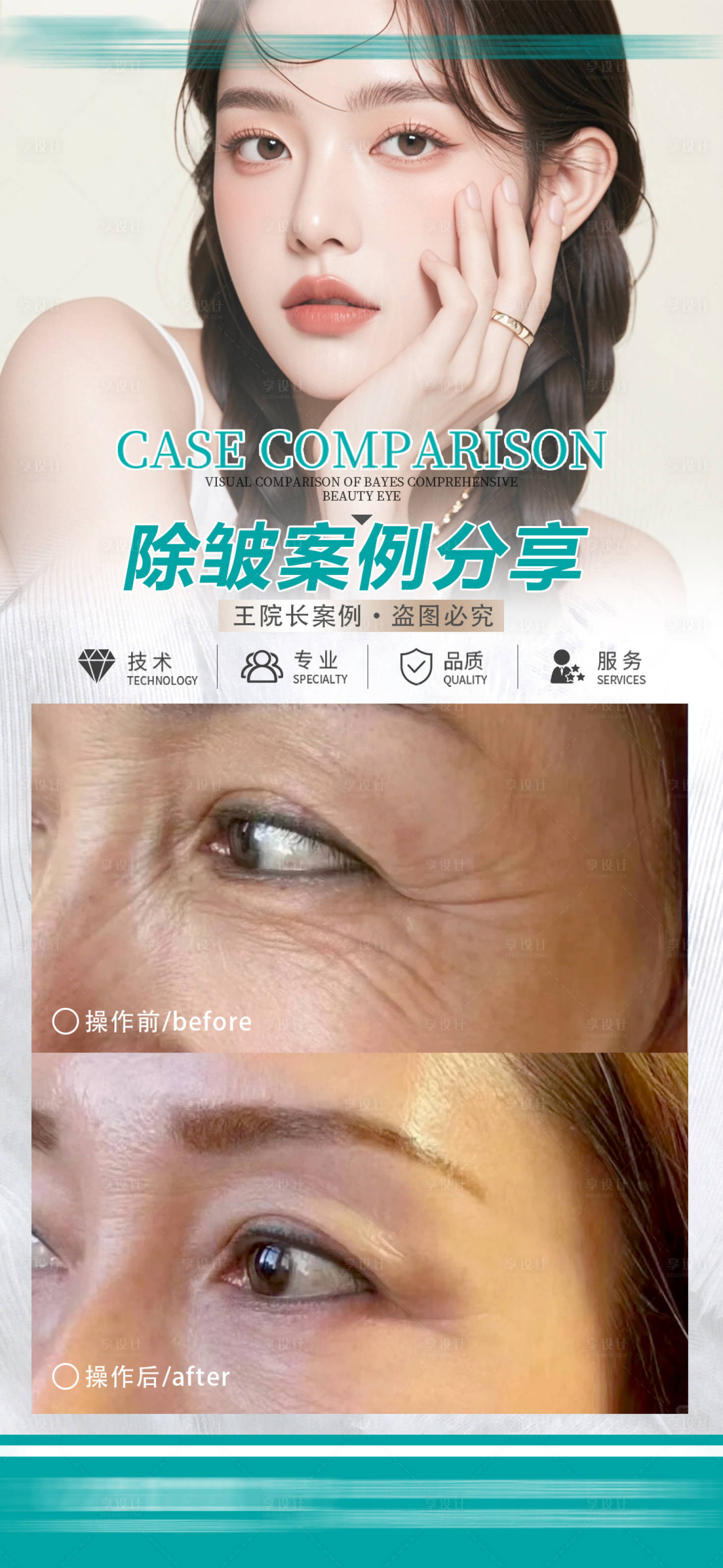 源文件下載【享設計】搜索編號：39410027416068084【醫美除皺案例海報】