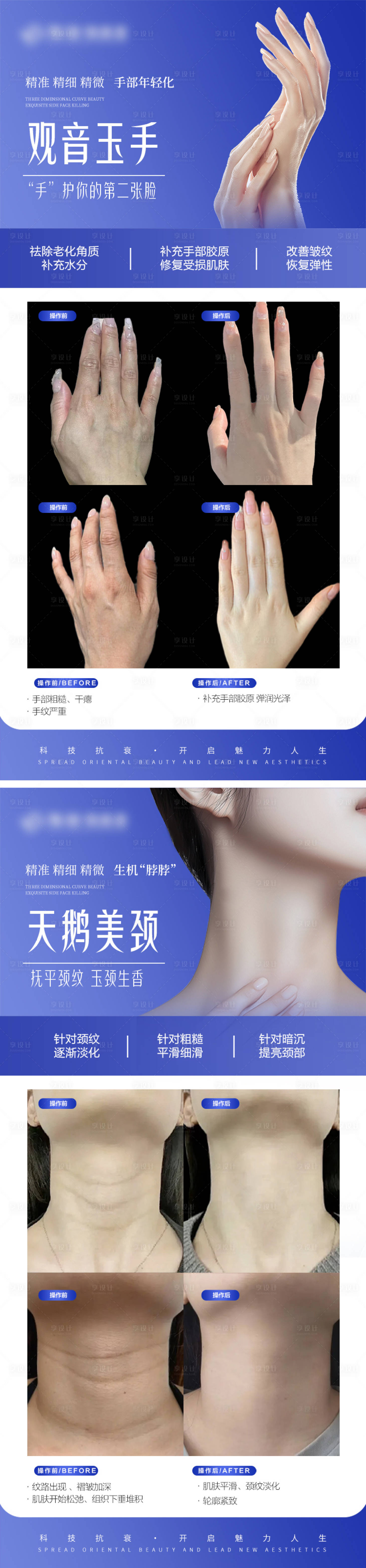 源文件下载【享设计】搜索编号：35350027237409134【医美手部颈部抗衰案例对比宣传系列海报】