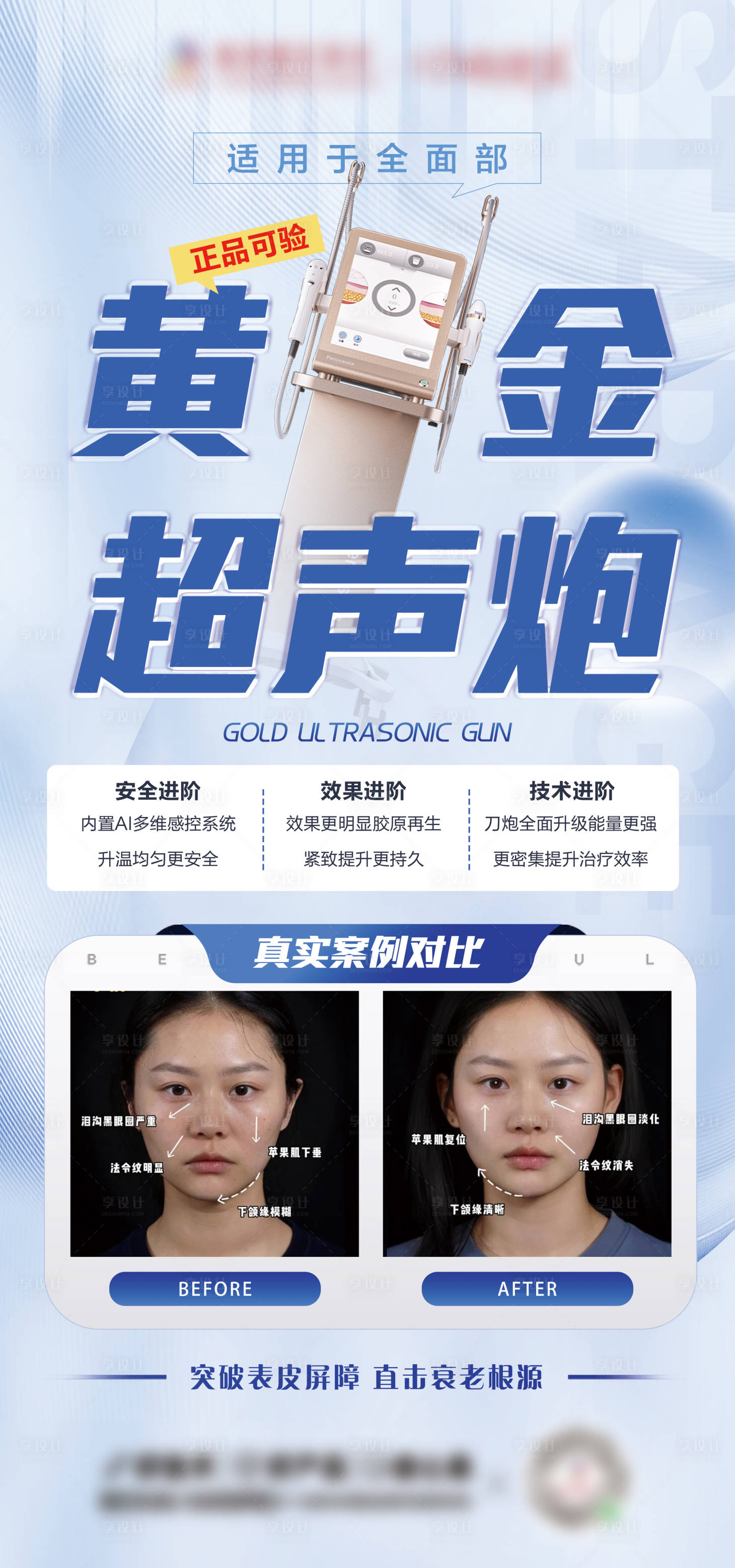 源文件下載【享設(shè)計】搜索編號：12280027261206851【黃金超聲炮案例】