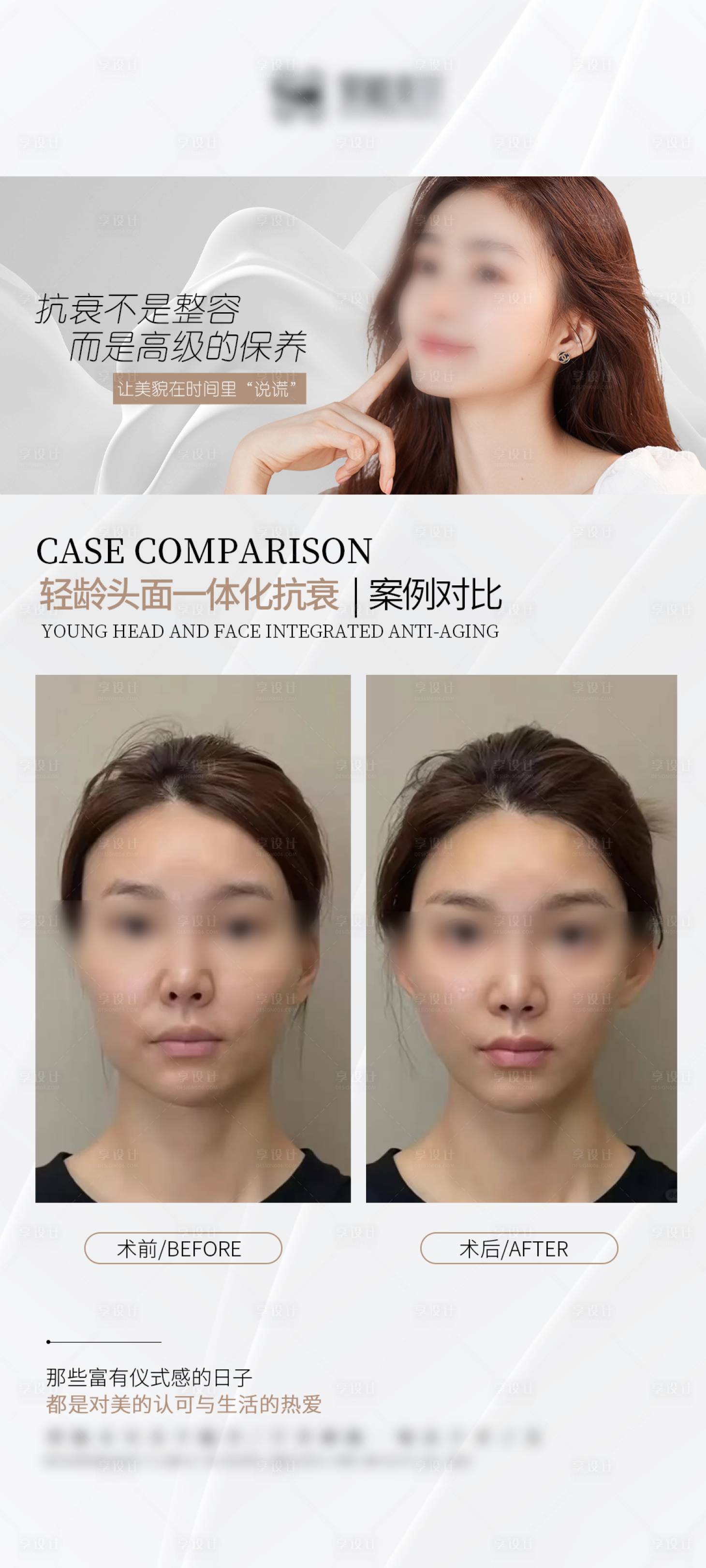 源文件下載【享設(shè)計(jì)】搜索編號(hào)：56150027456062894【醫(yī)美抗衰案例對(duì)比海報(bào)】