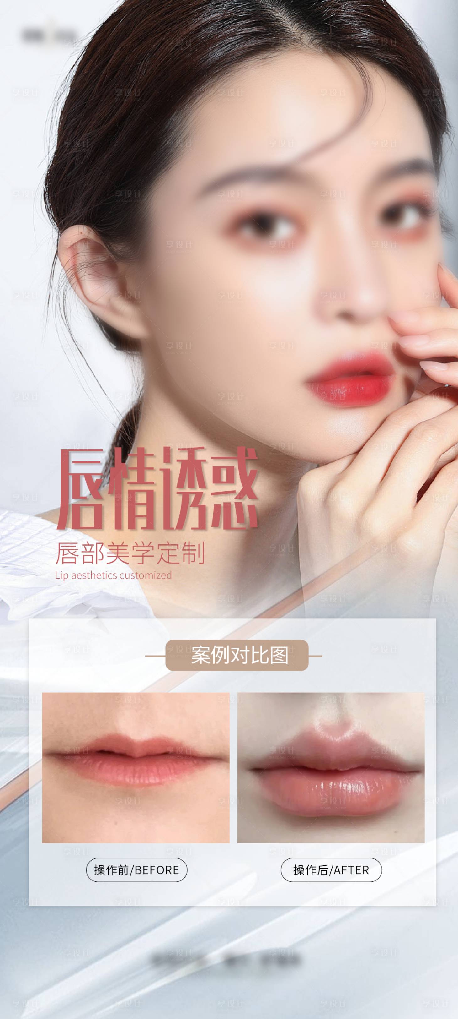 源文件下載【享設計】搜索編號：22110027166733663【醫美豐唇海報】