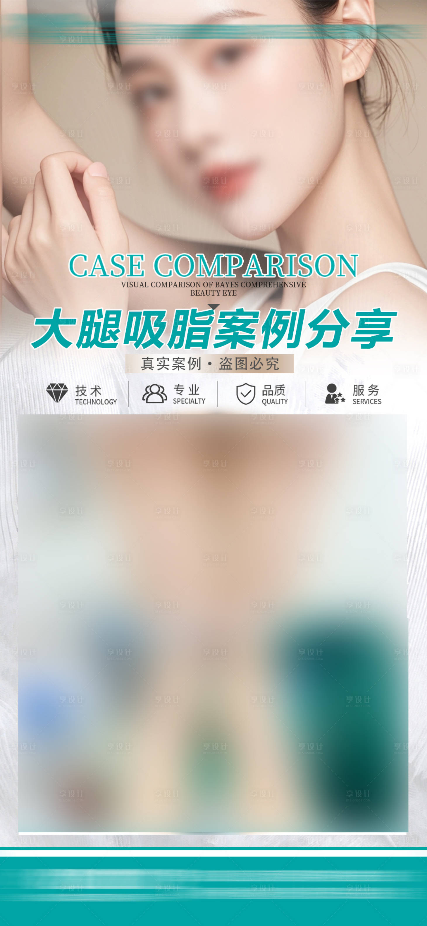 源文件下载【大腿吸脂案例】编号：42200027416942114