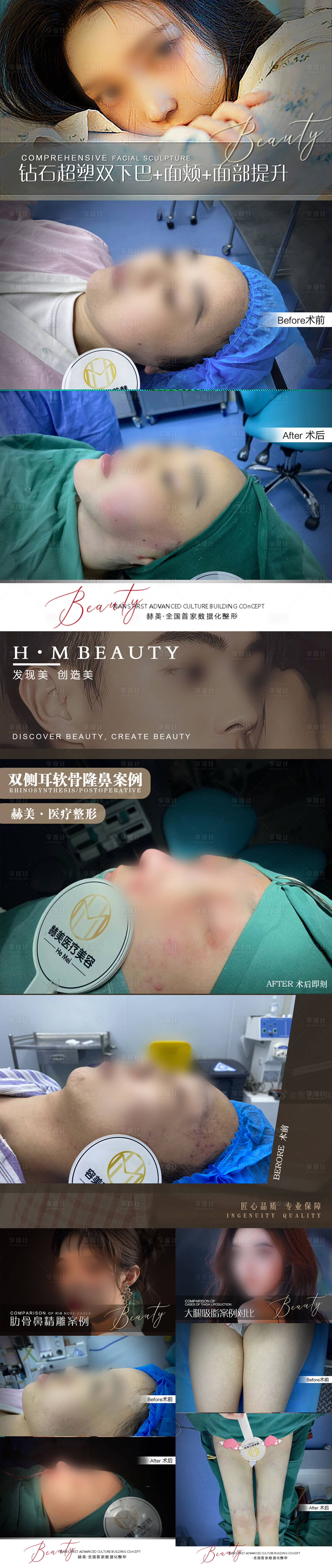 源文件下载【享设计】搜索编号：82640027295648131【医美案例对比海报】