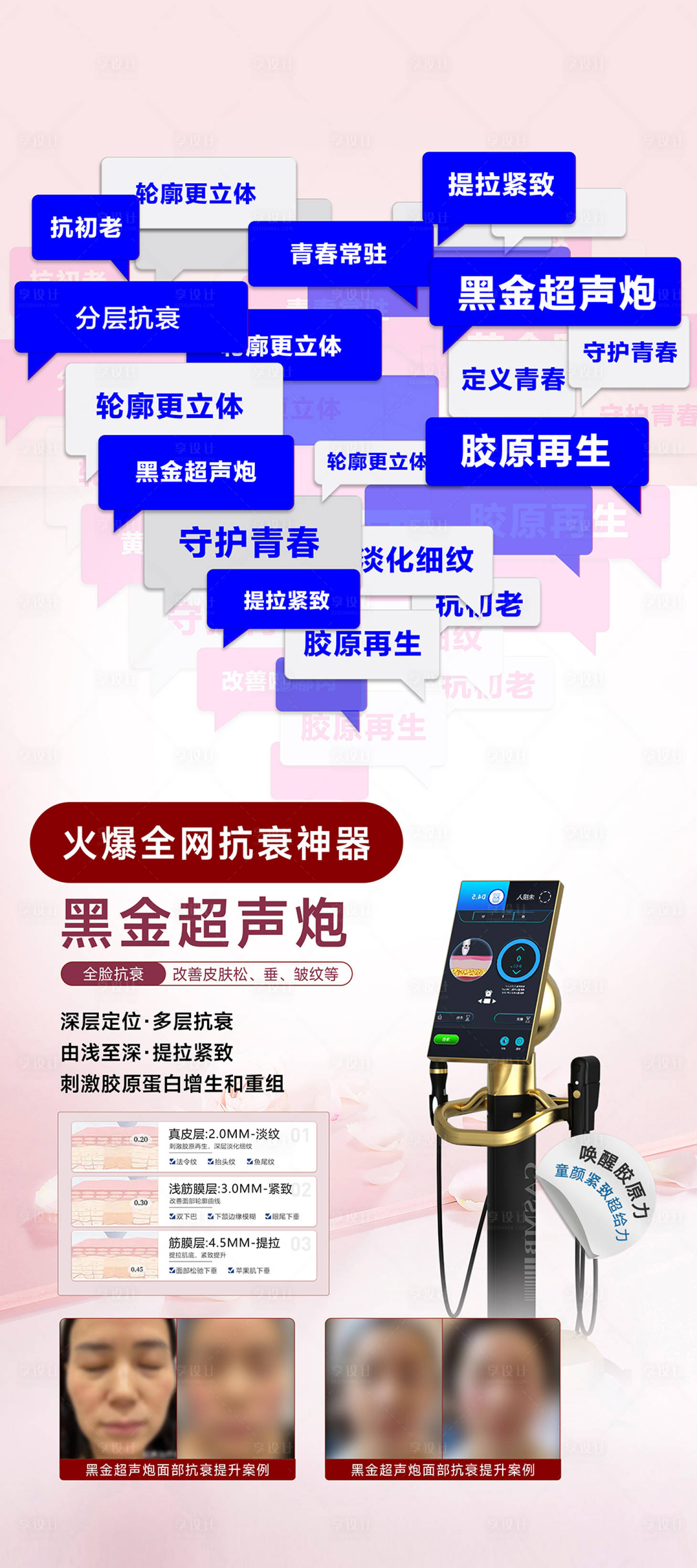 源文件下載【享設計】搜索編號：31470027171044271【超聲炮】